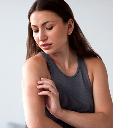 Infected Insect Bite