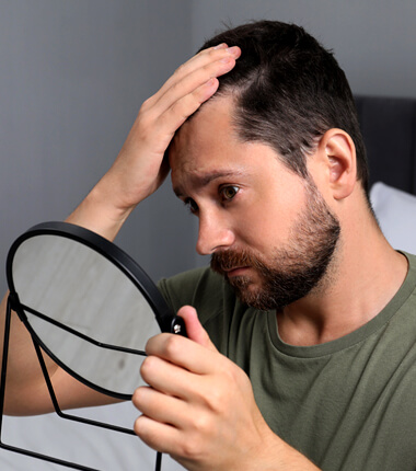 Men’s Hair Loss